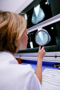 Entre juillet et septembre 2020, le nombre de mammographies traitées a été augmenté de plus de 40 %