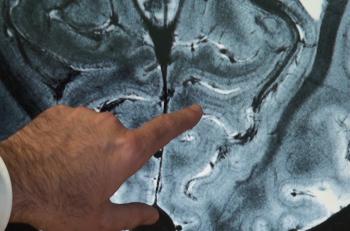 IRM 11,7T : le cerveau se révèle en détails